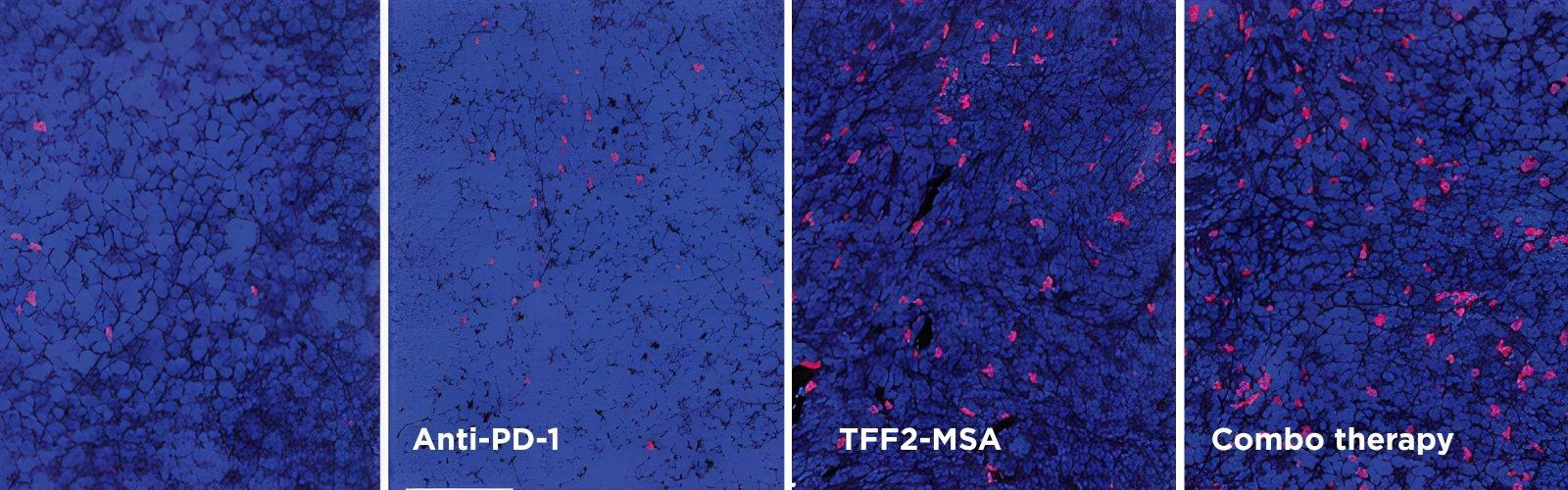 Enlarged area of tumor core, taken from Tim Wang's lab