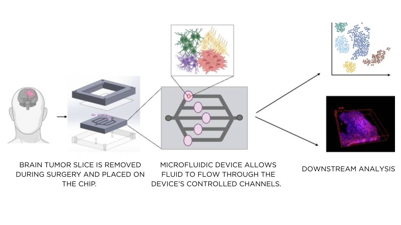 Diagram of a system for testing brain tumor drug responses through a microfluidic device