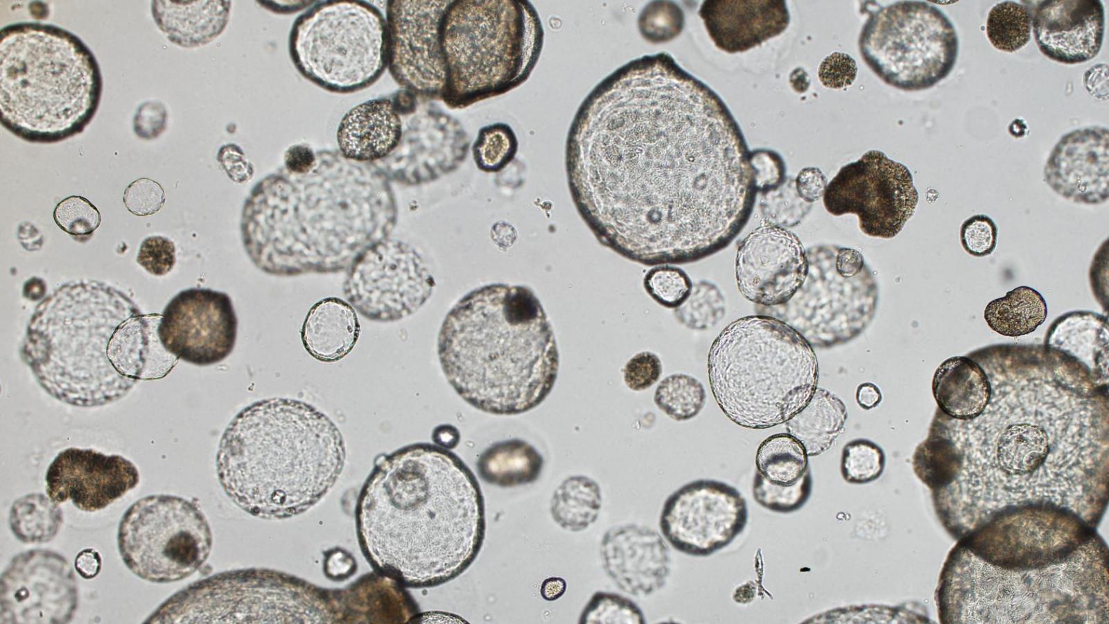 Image depicting pancreatic cancer 3D organoid cultures.