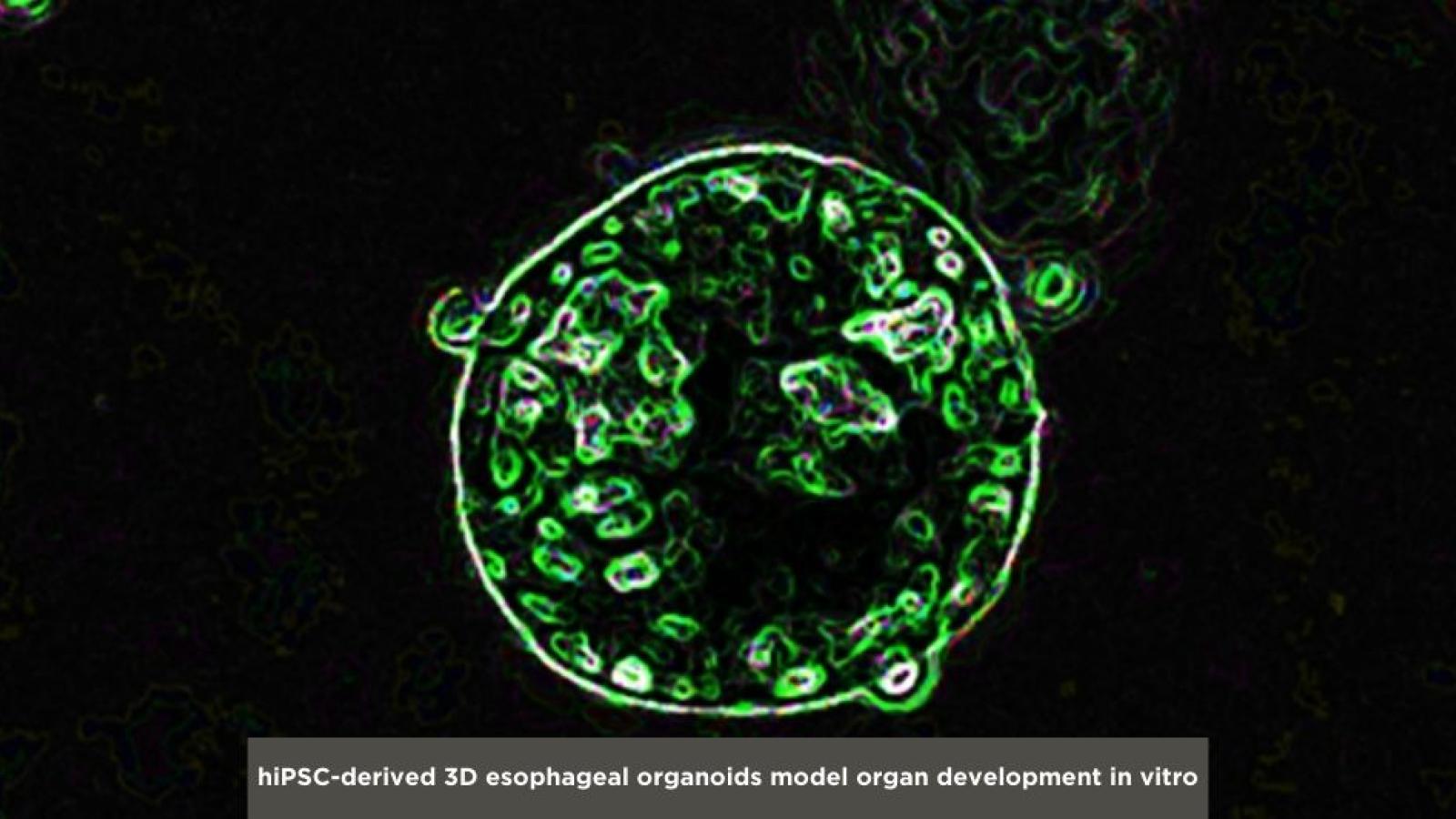 hiPSC-derived 3D esophageal organoids model organ development in vitro