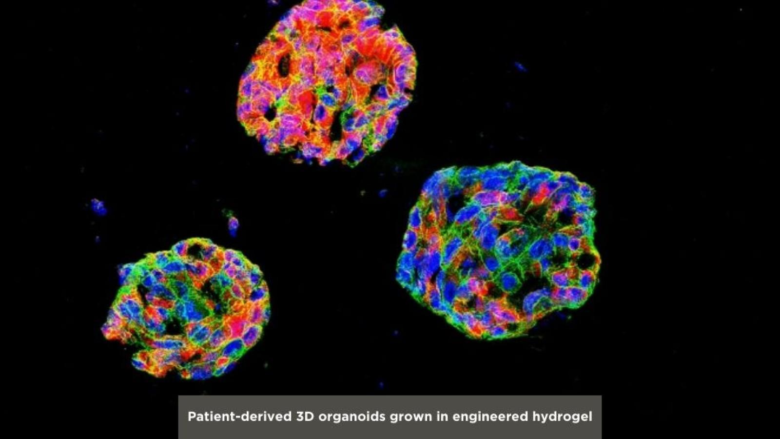 Patient-derived 3D organoids grown in engineered hydrogel
