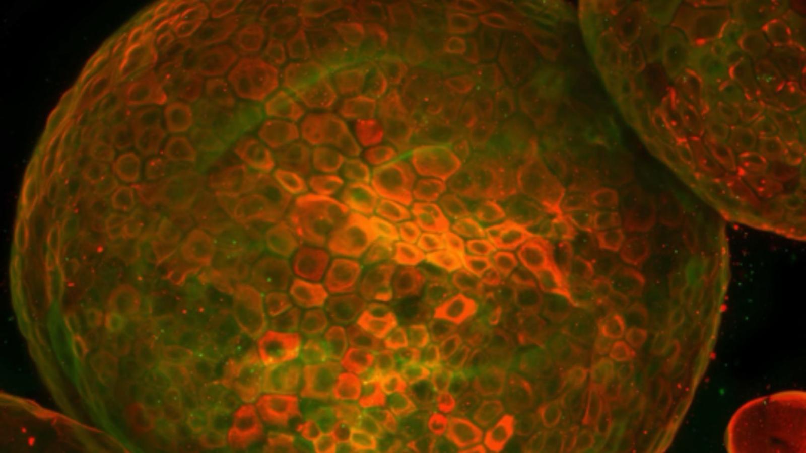 CC for ADM organoid From TAM-KCY mouse
