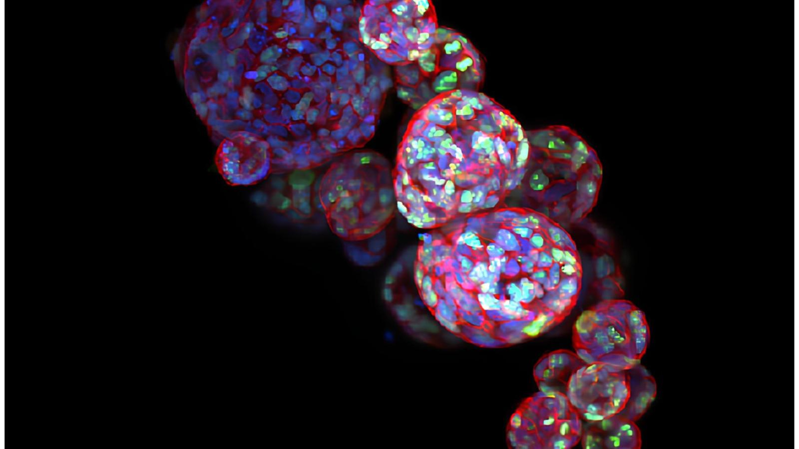 patient derived organoids