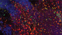Section of mouse medulloblastoma tumor