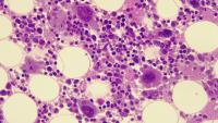 Image of human bone marrow as seen under the microscope