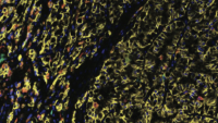 Colorful research image of tumor tissue