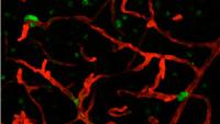 Image of therapy-resistant lung cancer cells hiding in the brain