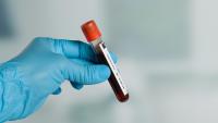Image of a gloved hand holding a test tube full of blood.