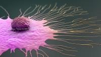 The image of a breast cancer cell.