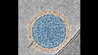 A color-enhanced microscope image showing an exosome (in blue) with PD-1 proteins on its surface (in brown). The black arrow points to the ring of PD-1.