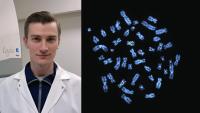 Doulaov on the left with an image of the chromosome of a cancer cell on the right