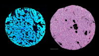 Breast topology images