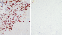 CXCR4 stained scans