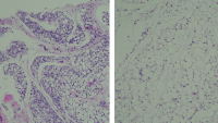 Brown Adipose Tissue