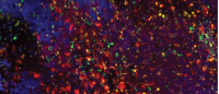 Section of mouse medulloblastoma tumor