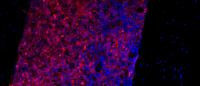 Representing research from Galan Diez-Kousteni team, myeloid leukemia cells (red) flooding the bone marrow of mice (Courtesy of Kousteni lab)