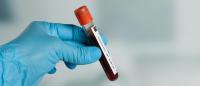Image of a gloved hand holding a test tube full of blood.