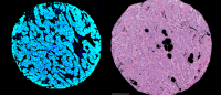 Breast topology images