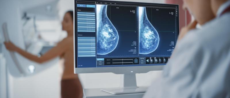 New Study Reveals Disparities in 3D Mammography Screenings for Breast ...